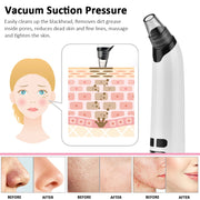 Facial Cleaner Blackhead Remover